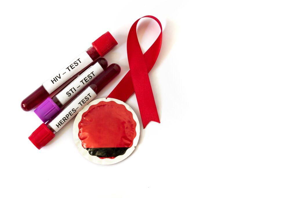 Wstążka AIDS z probówkami krwi z testów na choroby przenoszone drogą płciową i prezerwatywą na białym tle